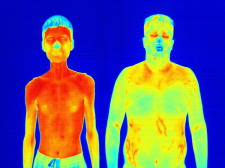 Infrared Thermal Imaging in Modern Healthcare